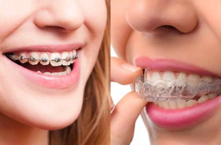 Orthodontics & Aligners