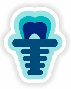 Root Canal Treatment