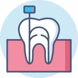Root Canal Treatment
