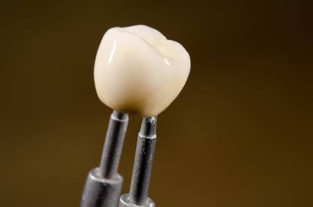 Dental Crowns