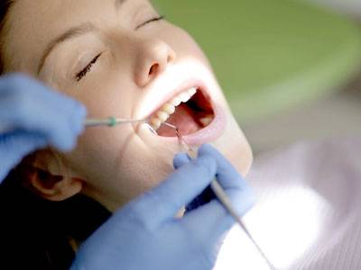 Dental Fillings