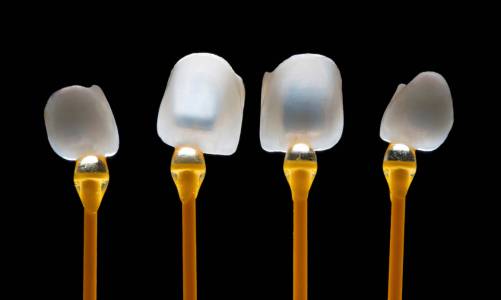 Dental Veneers