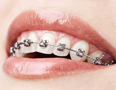 Orthodontics