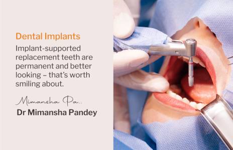 Dental Implants