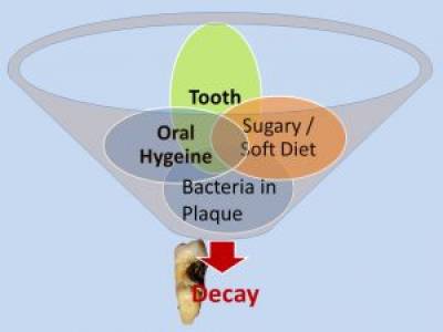 Tooth Decay