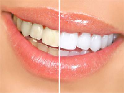 Cosmetic Dentistry