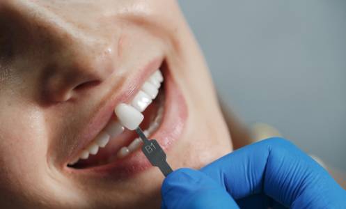 Periodontics Treatments