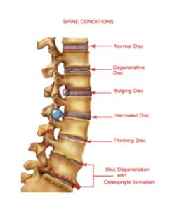Spine