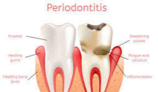 Periodontists