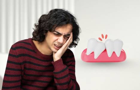 Wisdom Tooth Removal