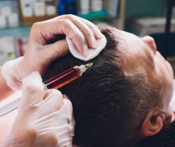 Hair Transplant