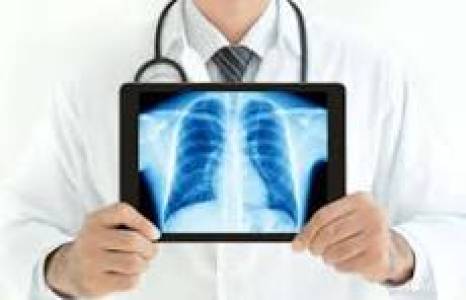 Digital X Ray