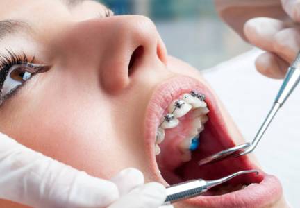Orthodontic Treatment