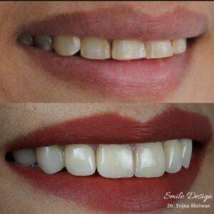 Cosmetic Dentistry
