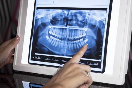 Digital X-Ray at Mehta Dental Clinic