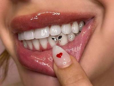 Tooth Jewelry