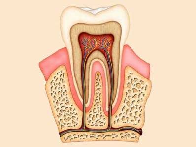 Root Canal