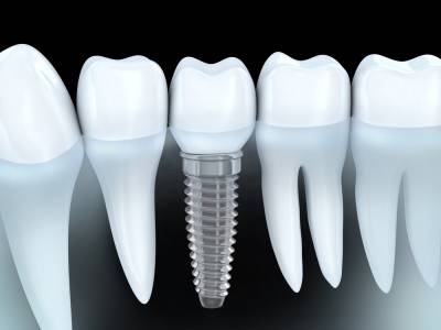 DENTAL IMPLANT & ORHTODONTIC CENTER