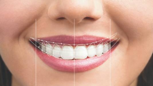 DIGITAL SMILE DESIGN
