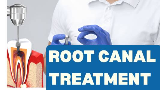 Root Canal Treatment