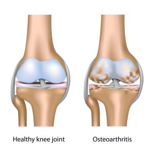 Orthopedics