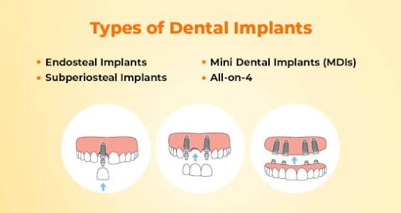 Teeth Reshaping Treatment
