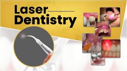 Laser Dentistry