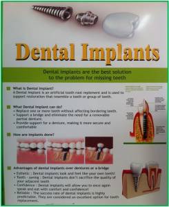 Dental Implants