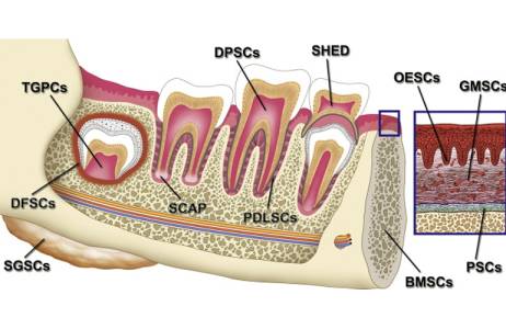Dental Stem Cell Therapy