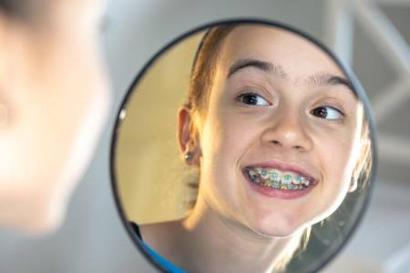 Orthodontic Treatment