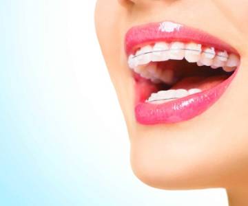 ORTHODONTIC TREATMENT