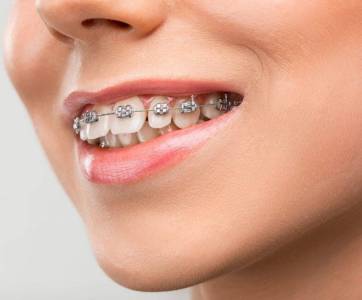 Proven Orthodontic Care for All Ages