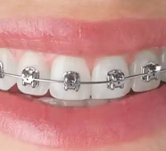 ORTHODONTIC Services