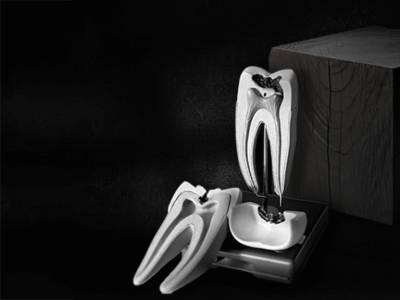 Wisdom Tooth Removal In RS Puram